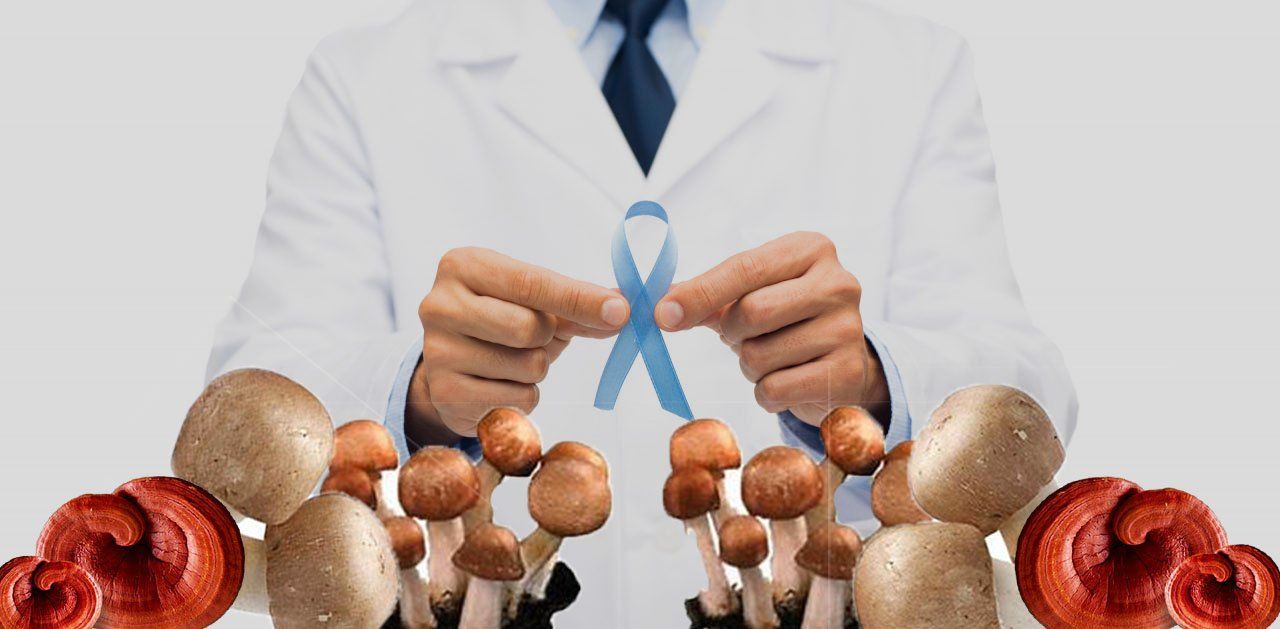 prosztata gomba prostate neuroendocrine carcinoma pathology outlines